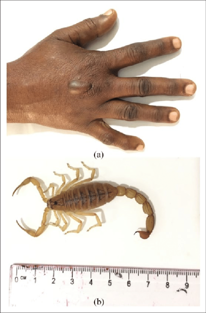 what does a scorpion bite look like - Scorpion Species